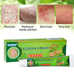 Skin eczema ointment - Lees Beauty and Self Care Bar